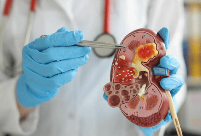 cose da sapere sulle malattie mitocondriali